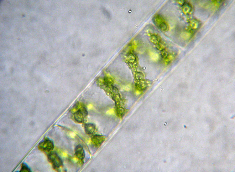 Alghe 3: Spirogyra sp